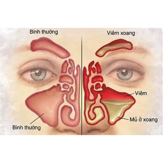 Dung Dịch Xịt Mũi DK Xoang - Lọ 15ml