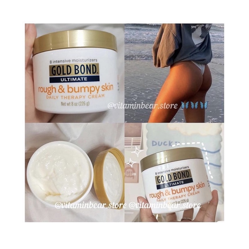 Kem dưỡng body gold bond rough and bumpy skin