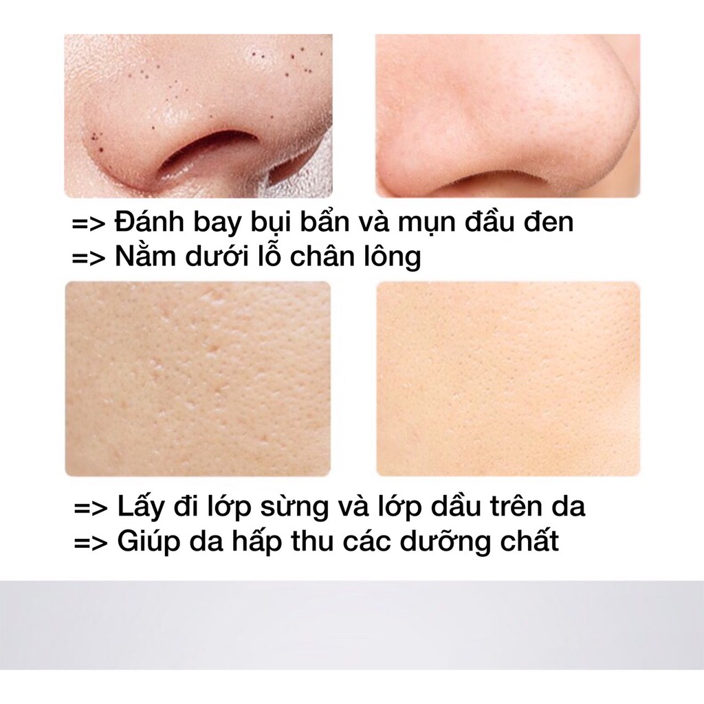 Máy cà da ion đẩy mụn đầu đen cám lấy bã nhờn da chết