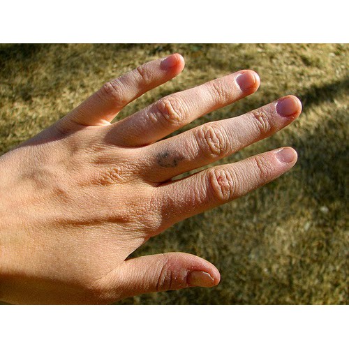 Kem Dưỡng Ẩm 3% Urê - Ziaja Med | BigBuy360 - bigbuy360.vn