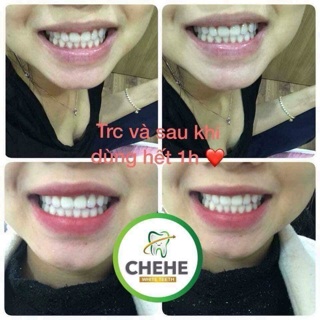 Bột trắng răng thảo mộc CHEHE