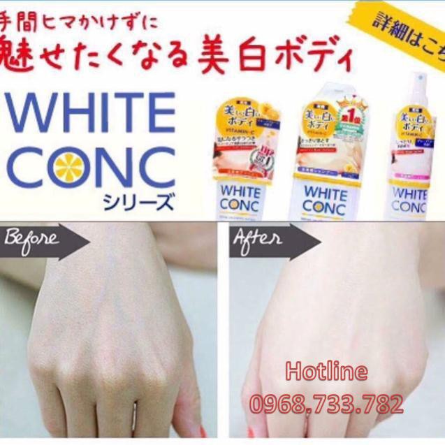 Kem dưỡng trắng da White Conc Watery Cream 90g