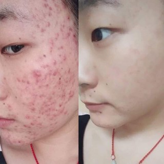 Sữa rửa mặt CERAVE