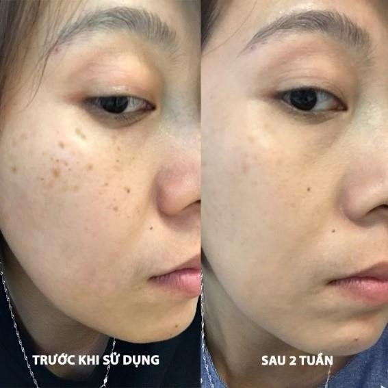 Tinh Chất Giảm Thâm Nám Dạng Bút Chấm EUCERIN UltraWHITE+ SPOTLESS SPOT CORRECTOR 5ml