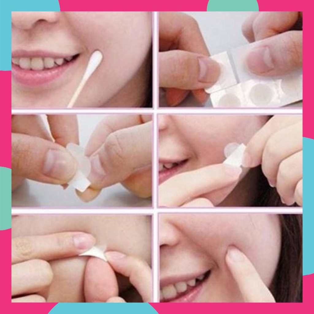 Miếng Dán Mụn  Acnes Clear Patch - Mụn Cóc - mụn đầu đen - chăm sóc da - da nhạy cảm - nền - mỹ phẩm - mỹ phẩm - ĐYVĐ! | BigBuy360 - bigbuy360.vn