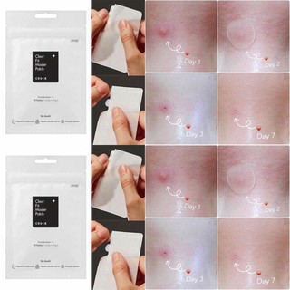 Miếng Dán Mụn Cấp Tốc Cosrx Acne Pimple Master Patch