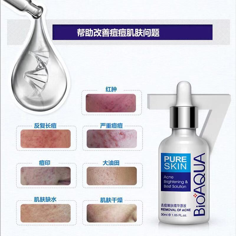 (Hàng Mới Về) Serum Trị Sẹo Mụn 30ml Bioaqua Cao Cấp