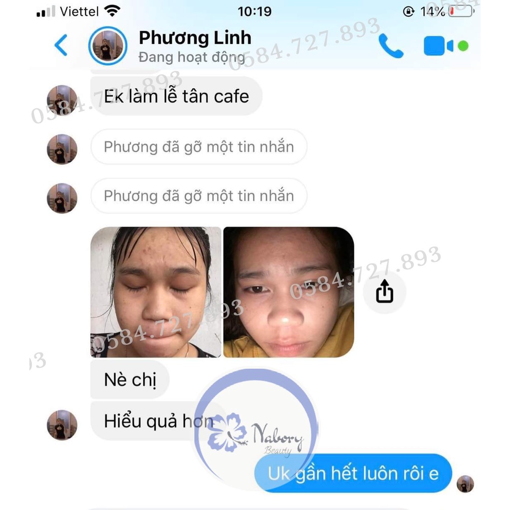 Combo 2 hộp kem mụn đông y Nabory Beauty [Quà bột đắp mặt] | BigBuy360 - bigbuy360.vn