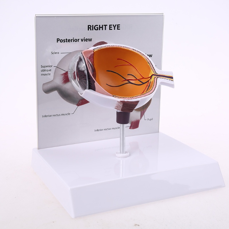 Wer Mô Hình Bóng Mắt Phải Người Cho Trưng Bày Glaucoma Cross Section Anatomical Glaucoma Teac