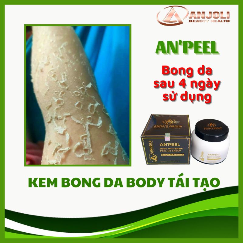 COMBO SỈ 5 KEM BONG DA BODY