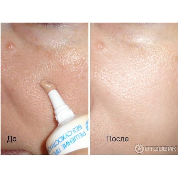 Kem nền Pure line 10in1 | BigBuy360 - bigbuy360.vn