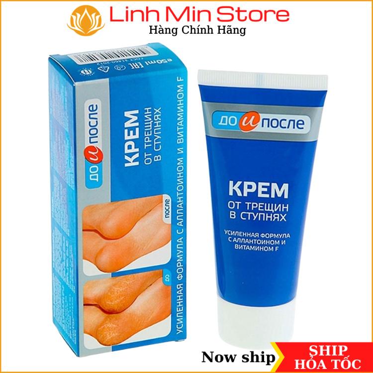 Kem Giảm nứt gót chân Kpem Apteka Nga 50ml Chính Hãng Mới