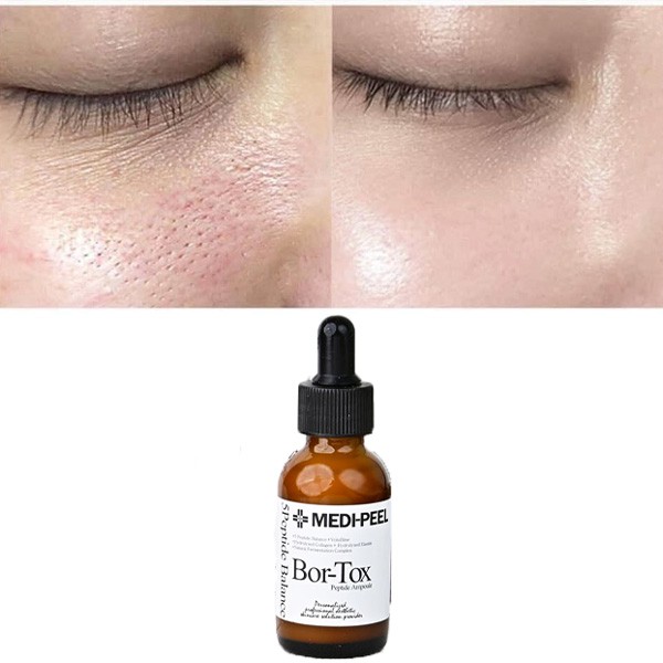 Tinh Chất Căng Bóng MEDI-PEEL Bor -Tox Peptide Ampoule Medi Peel Bortox 30ml.