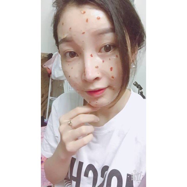 Mặt nạ thạch Collagen Hoa hồng - Mặt nạ trắng da, mờ vết thâm - Vincentshop