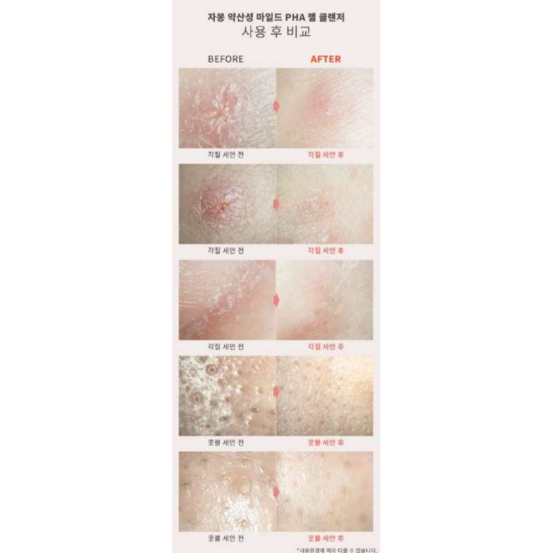 SỮA RỬA MẶT JAMONG HOPE GIRL HÀN QUỐC(HUKSAMSOO) | BigBuy360 - bigbuy360.vn