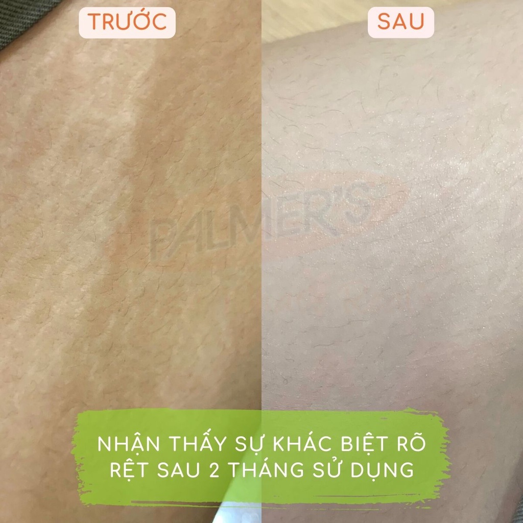 (Mẫu dùng thử) Lotion ngăn ngừa và làm giảm rạn da khi mang thai Palmer's 5ml