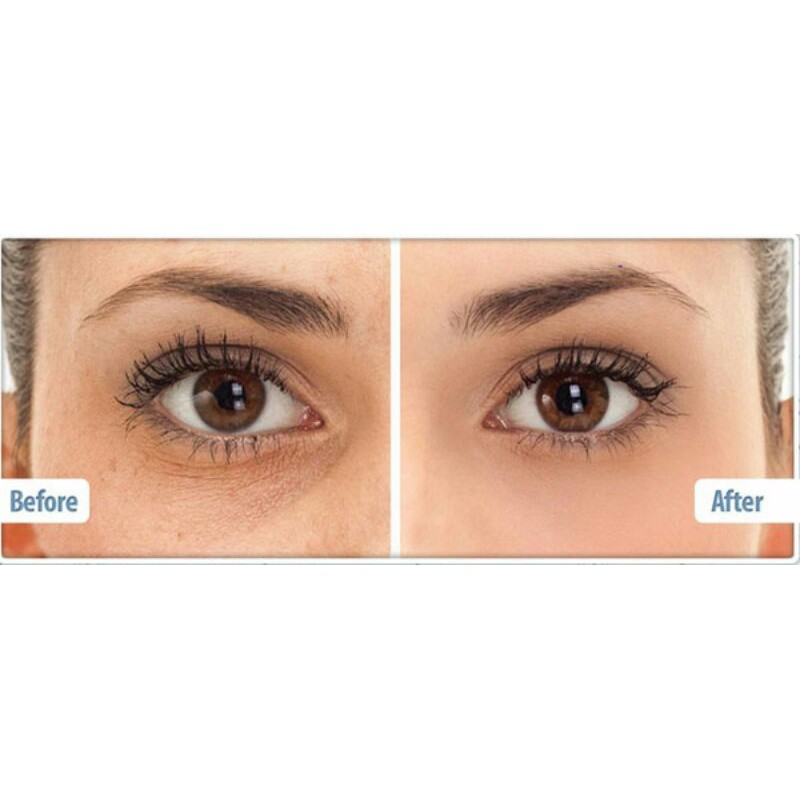 [5/15ml] Origins Ginzing Refreshing Eye Cream to Brighten and Depuff Kem mắt giảm thâm, tan bọng mắt | BigBuy360 - bigbuy360.vn