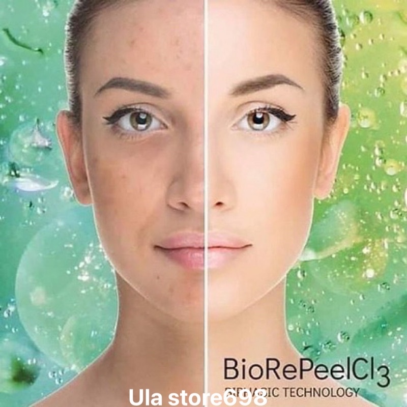 Tinh Chất Peel Da Italy Giảm Mụn Căng Bóng Trẻ Hóa Da Biore Peel.Cl3