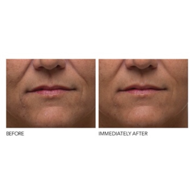 Bộ peel da Dr Dennis Gross Extra Strength Daily Peel