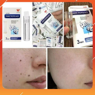 Gel tẩy nốt ruồi Nga