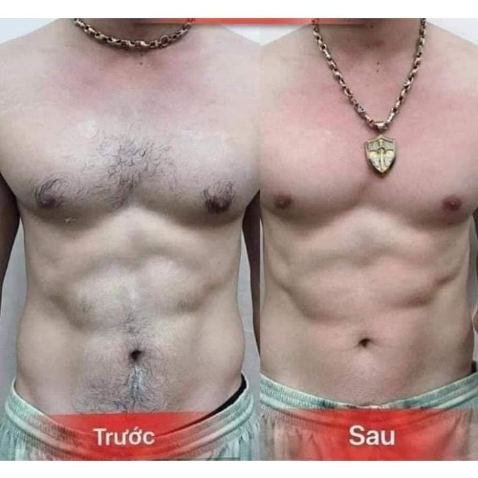 COMBO KEM TẨY LÔNG CHANH GẤC DIAMOND SKIN CHÍNH HÃNG (TRIỆT LÔNG CHANH GẤC DIAMOND SKIN) | BigBuy360 - bigbuy360.vn