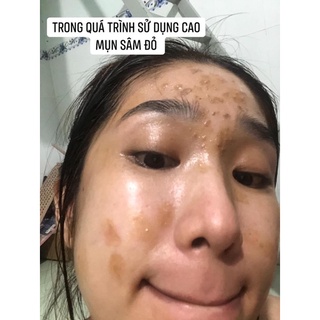 CAO MỤN SÂM ĐỎ
