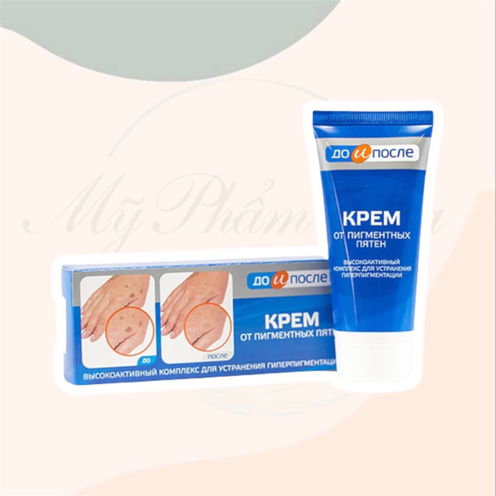 Kem đồi mồi Nga - Kem dưỡng chống lại các đốm đồi mồi