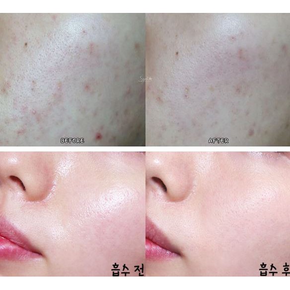 Kem Giảm Mụn La Roche Posay Effaclar Duo+ Corrective Unclogging Care Antiimperfections Anti-Marks Anti-Reoccurence 40ml