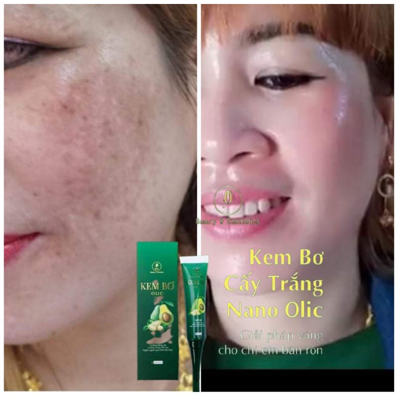 OLIC CHĂM SÓC DA MẶT | BigBuy360 - bigbuy360.vn