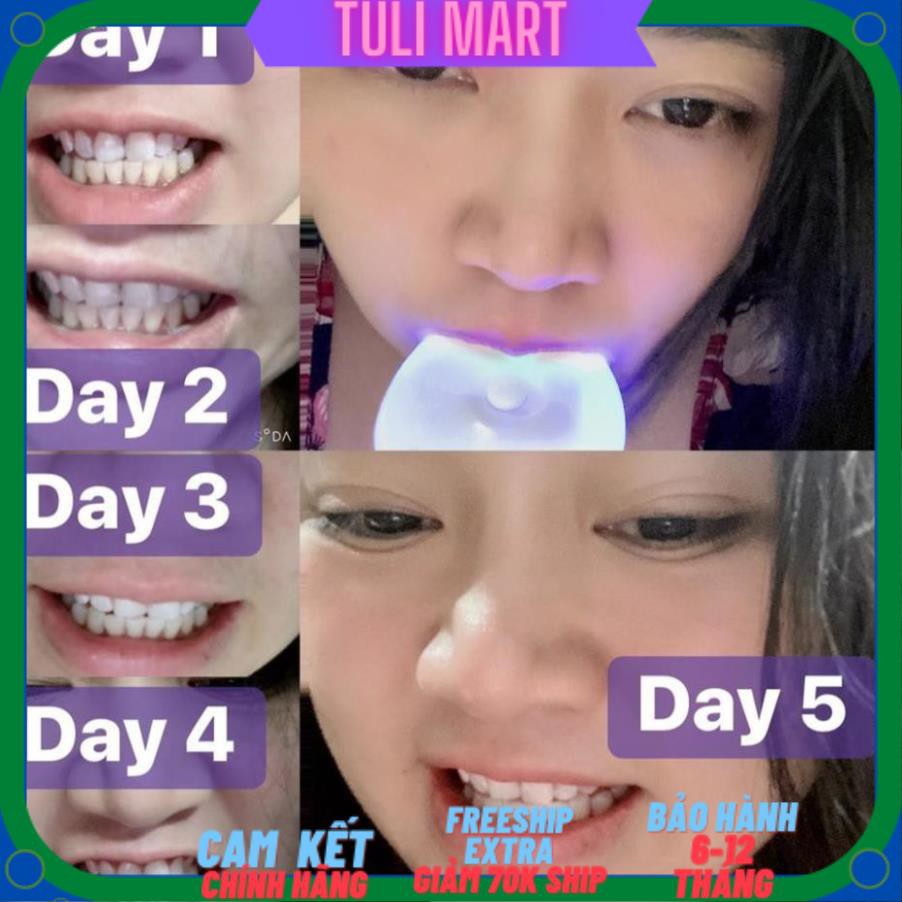 [ Hàng ÚC] Máy làm trắng răng bằng ánh sáng xanh White Glo White Accelerator Blue Light Teeth Whitening System