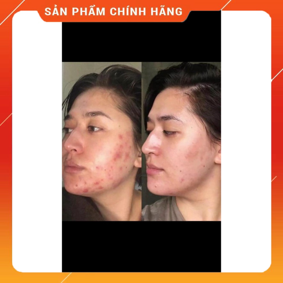 - Kem LA ROCHE POSAY CICAPLAST B5 PHỤC HỒI DA HƯ TỔN