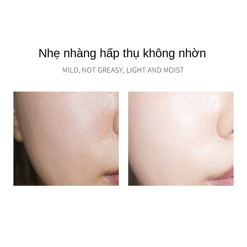 Mặt Nạ Venzen Dưỡng Ẩm Làm Sáng Tông Màu Da Hiệu Quả