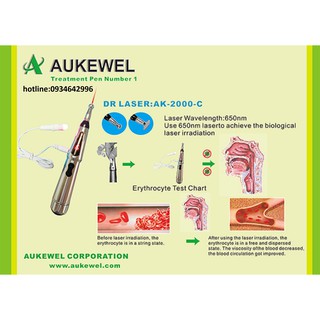 Máy dò huyệt châm cứu Aukewel AK 2000B