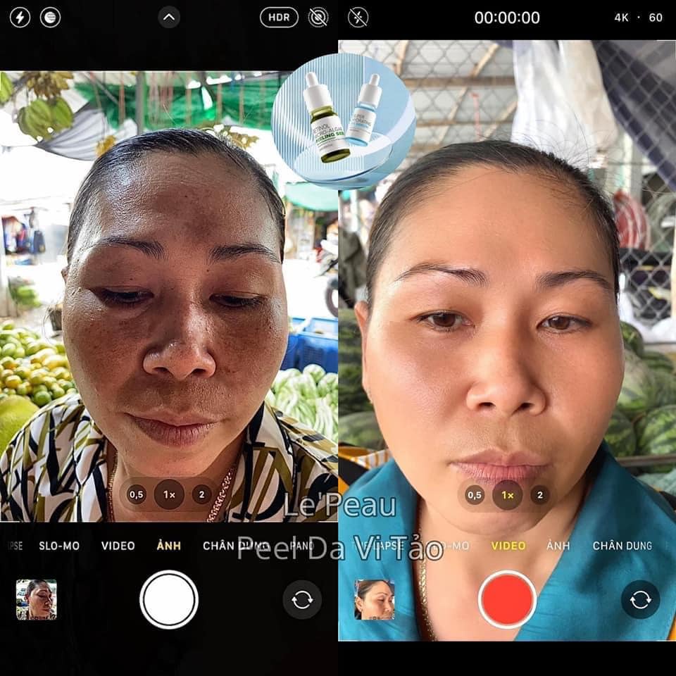 Peel da vi tảo Lepeau sạch mụn thâm sẹo rỗ, hàng công ty phân phối chính hãng giá sỉ - dhviet