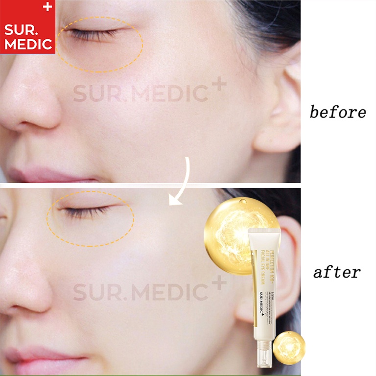 Kem dưỡng Sur Medic giảm thâm mắt, làm mờ nếp nhăn chống lão hóa All In One Facial Eye Cream