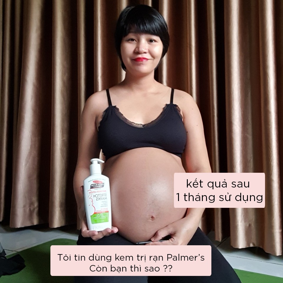 [Mã FMCGMALL -8% đơn 250K] Lotion ngăn ngừa và làm giảm rạn da khi mang thai Palmer's 250ml