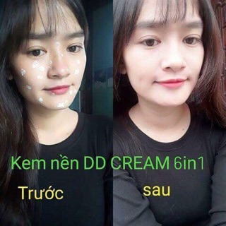 Kem nền DD 6 trong 1
