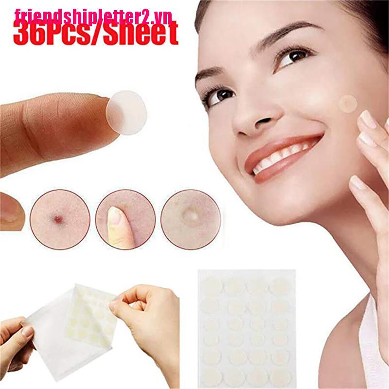 (Hàng Mới Về) Set 36 Miếng Dán Trị Mụn Chăm Sóc Da Hiệu Quả