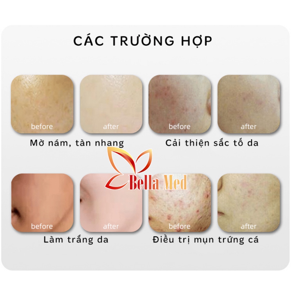 vòm ánh sáng sinh học phun sương nano nút bấm cảm ứng Spa Face