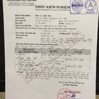 PHẤN NỤ MẪU ĐƠN GREENBON