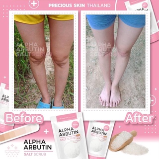 Muối tẩy da chết Alpha Arbutin