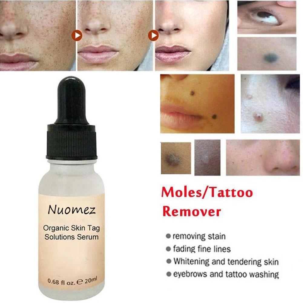 Tinh chất tẩy nốt ruồi và tàn nhang không đau không để lại sẹo tiện dụng 27H9 | BigBuy360 - bigbuy360.vn