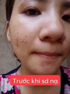 Mặt nạ yến tươi collagen