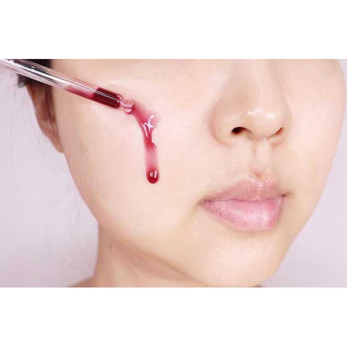 Serum Red peel Tái Tạo Da 35ml TREEHOUSE SHOP