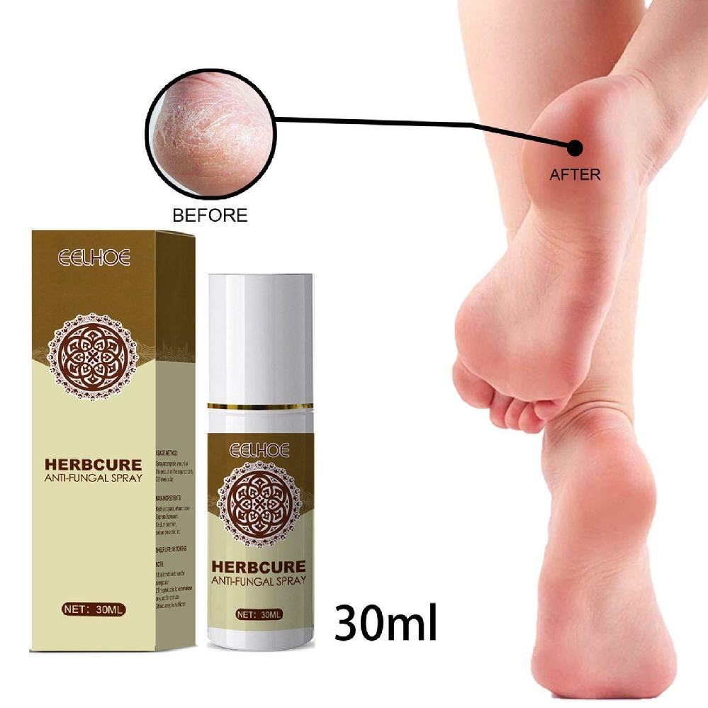 [Hàng mới về] Xịt dưỡng bàn chân thảo dược cải thiện tình trạng nấm chăm sóc làn da 30ml