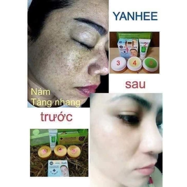 KEM NÁM TÀN NHANG TRẮNG DA YANHEE THÁI LAN.