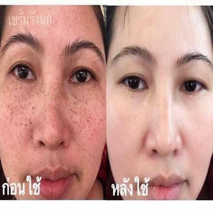 Bộ Kem Nám Sạm Da Chính Hiệu Yahee Thái Lan