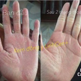 KEM ĐA NĂNG