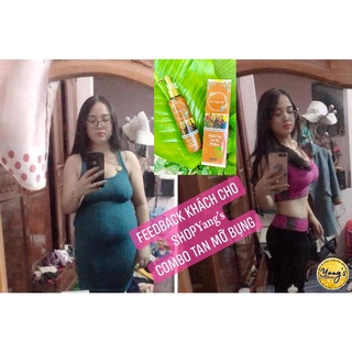 CAO GỪNG HỦY MỠ, CAO GỪNG XOA BÓP ĐÔNG Y GIẢM MỠ