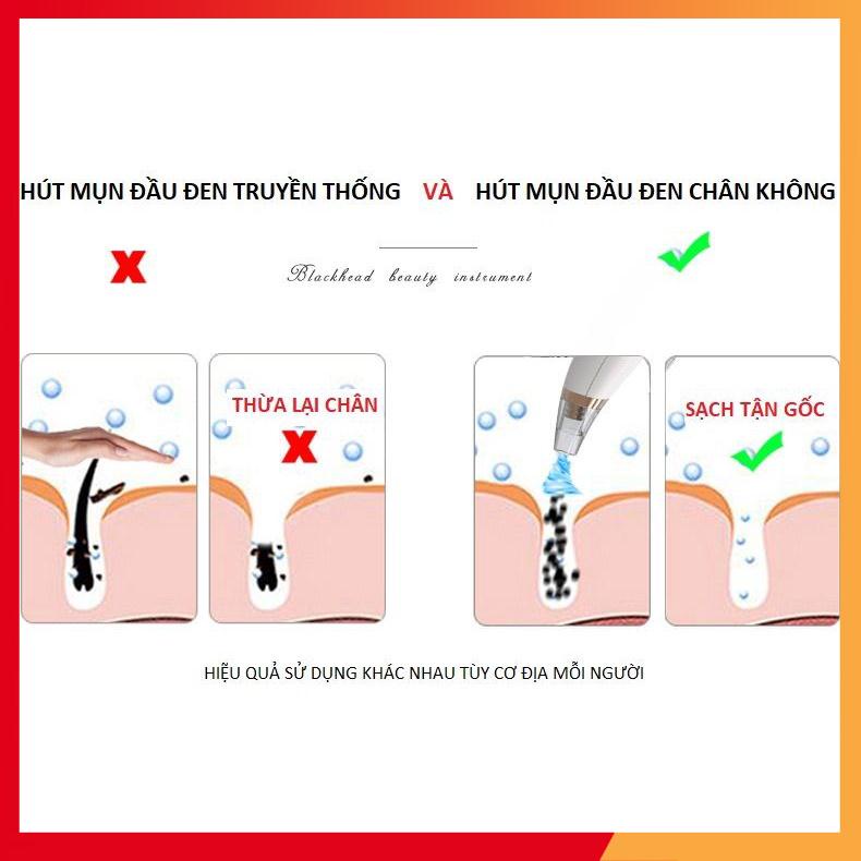 Máy hút mụn mini cầm tay 3 đầu hút siêu tiện lợi